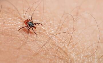 Prisatie kliešťa môže viesť k ochrnutiu aj úmrtiu. Ako sa pred ním chrániť a čo robiť?