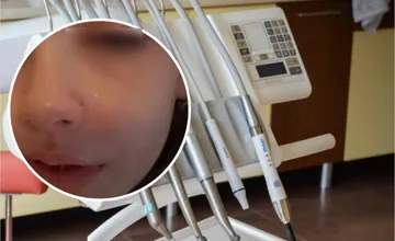 Mama z Nitry sa posťažovala na zubné pohotovosti v meste, po víkende plnom bolesti pomohli jej dcérke až v Bratislave