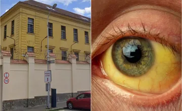 V nitrianskej väznici aktuálne vyčíňa žltačka typu A, niektorí väzni musia byť v karanténe