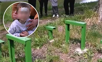 Chvíle hrôzy pri jazierku v Tlmačoch: Trojročný chlapec zakopol a rozbil si hlavu o ostrý kov, rodina viní mesto