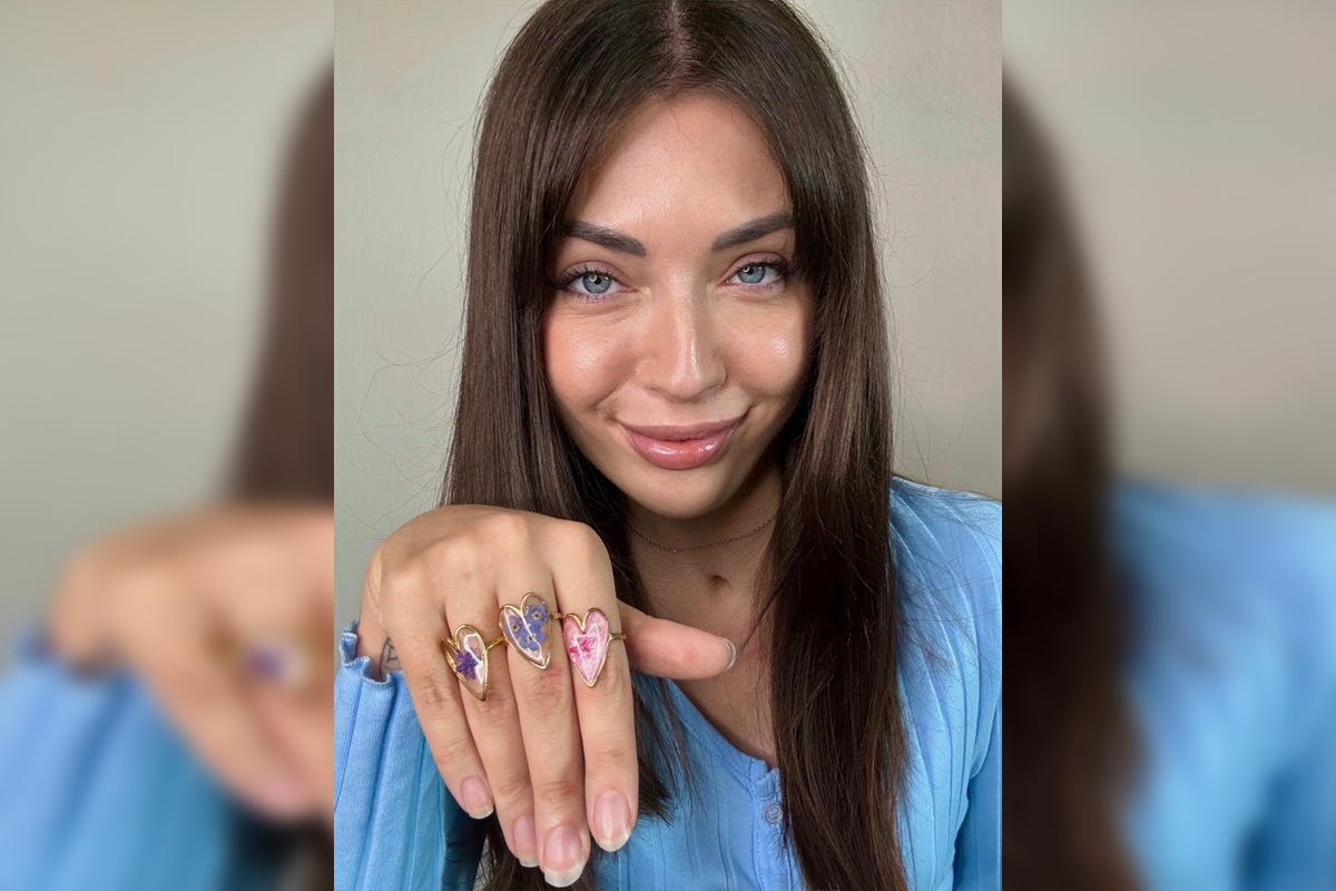 FOTO: Ischémia miechy zmenila život Mišky z Veľkého Kýru na Cypre, teraz sa tam vrátila. Snívala som o tom, hovorí , foto 3